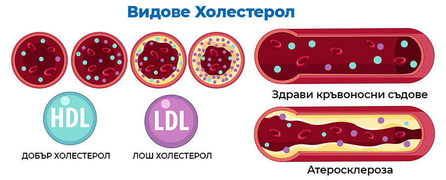 Видове холестерол - кръвоносни съдове